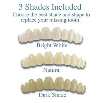 SmileFix Instant Tooth Kit